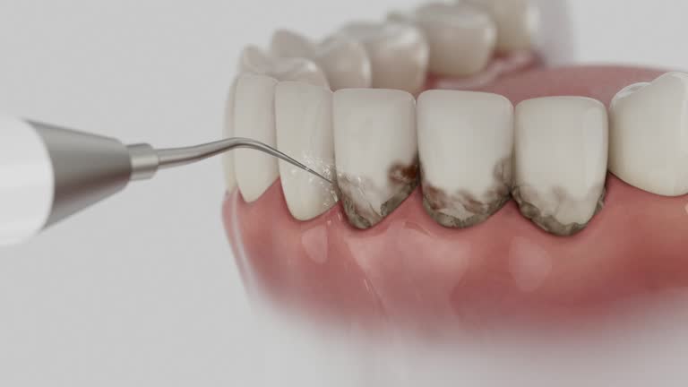 Reliable Dental Implants contractor in Paynesville, MN by Smile Center Dentistry